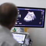 En 2021, un médecin sur quatre en Suisse était âgé de 60 ans ou plus (image symbolique). KEYSTONE/GAETAN BALLY